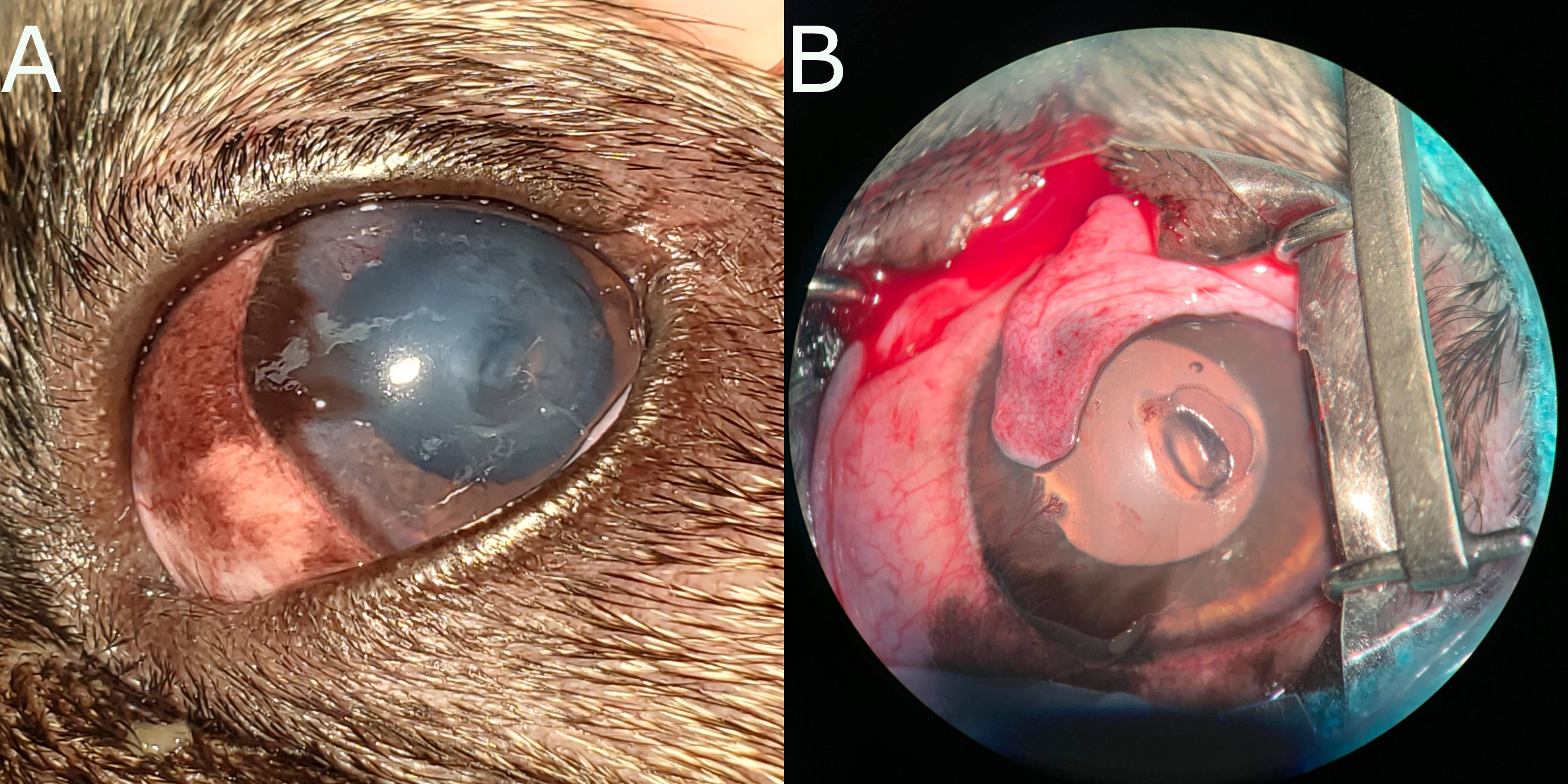 A) A descemetocoele in the cornea of a dog. Note the deperessed area just below center. The cornea is cloudy, due to corneal edema, and there is some pigmentation of the corneal epithelium. B) Intraoperative photograph of the same descemetocoele. The lesion has been debrided (i.e. dead corneal epithelium and stroma has been removed), resulting in the larger appearance. Note that the periphery fo the descmetocoele appears shallower - this illustrates how the tissue surrounding the deep ulcer was also affected, and would have delayed healing. Photographs courtesy of Alanna MacKinnon (AVC 2021).