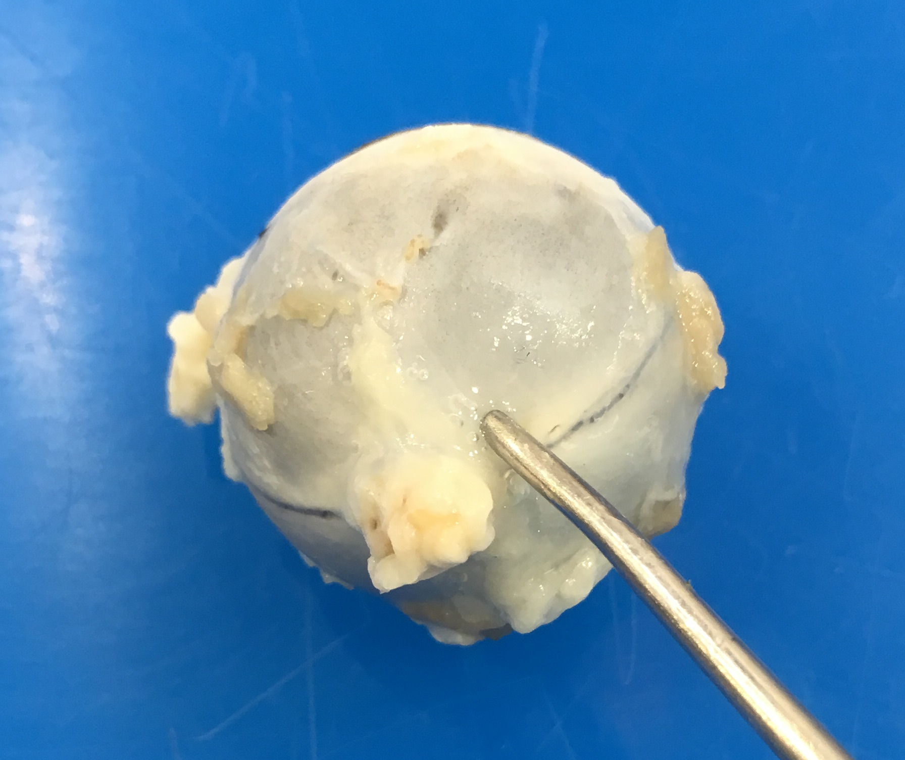 Landmarks for injecting the globe with formalin. You are viewing the caudal aspect of the globe. The probe (representing an ideal location to inject formalin) is at the caudal aspect of the eye, and just slightly dorsal.