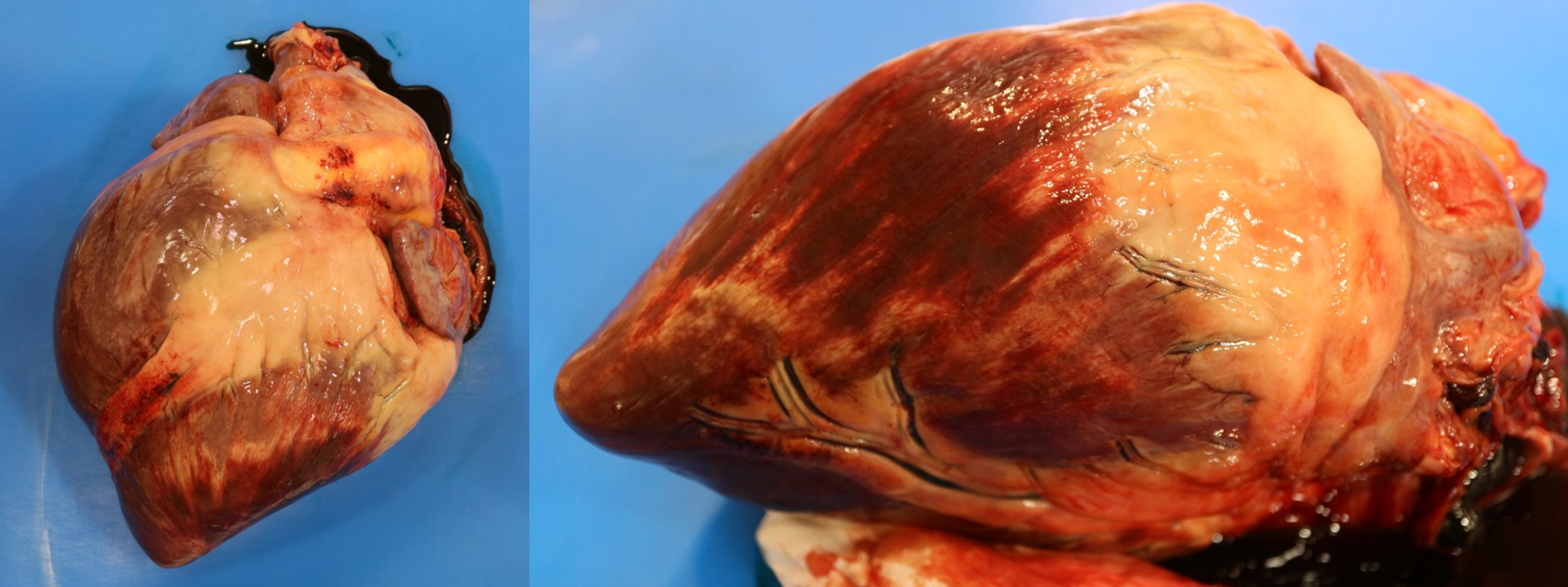 Necrosis of the myocardium. Pale white streaks bordered by hemorrhage are visible throughout the ventricle. Photo: C. Martin